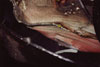 Accident 6